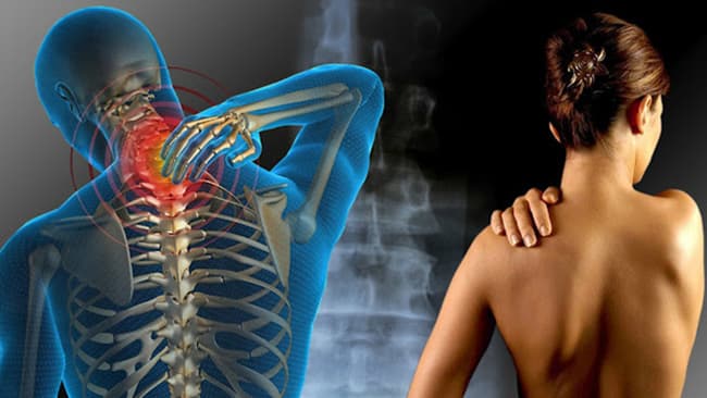 Mệt mỏi trong Đau cơ xơ hóa - Hướng Dẫn Kiểm Soát Triệu Chứng & Cải Thiện Chất Lượng Cuộc Sống,đau cơ xơ hóa
